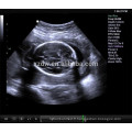 machine d&#39;ultrason 4d et machine d&#39;ultrasonography et équipement échographique vaginal